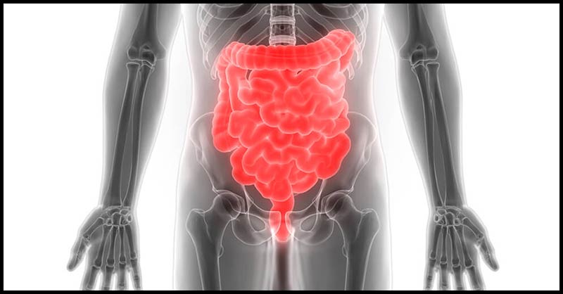 How To Protect Our Colon