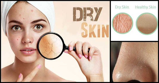 Foods That Can Hydrate And Moisturize Dry, Flaky Skin