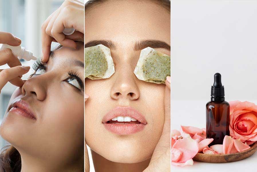 Eye Infections: 5 Effective Home Remedies That May Help Treat Common Eye Problems